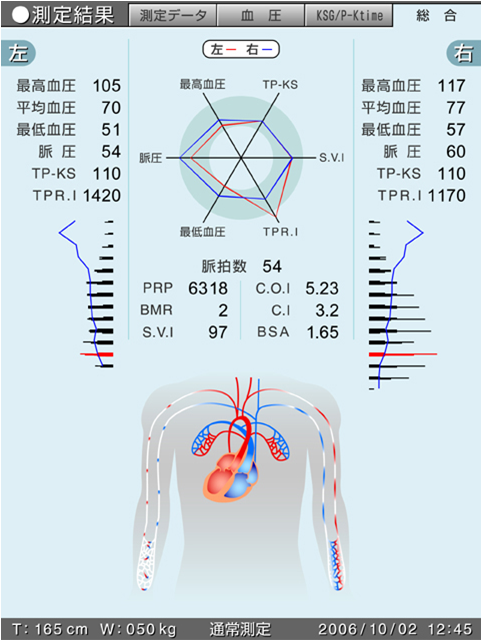 両腕同時血圧血流測定